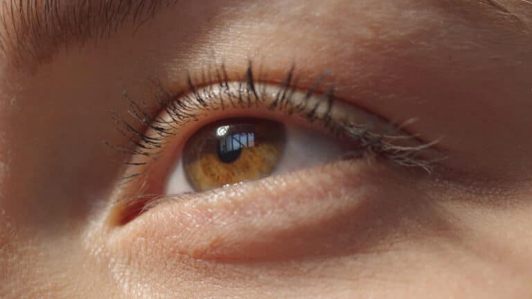 What Are the Benefits of SMILE Eye Surgery Over LASIK?