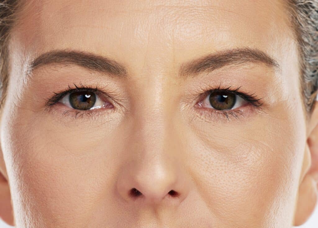 , Introducing RevitalEyes: A Transformative Approach to Dry Eye Treatment, Vold Vision